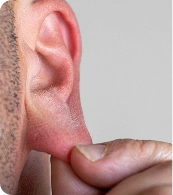 Earlobe Anatomy