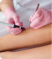Hair removal