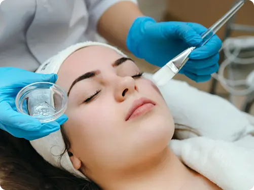 Peel & Melasma Treatment
