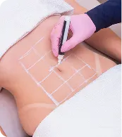 Fat Reduction