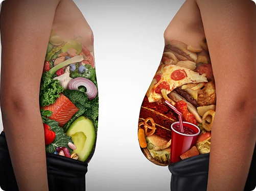 Diploma in Obesity Management by Food