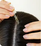 Scalp Micropigmentation