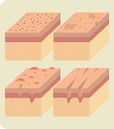 Skin Anatomy